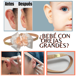 BANDA PARA LA CABEZA  con soporte de adhesivo,  PARA MEJORAR la apariencia de las orejas de forma gradual SIN DOLOR